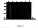 Fig. 09 - FERRITIN AS A THERAPEUTIC TARGET IN ABNORMAL CELLS
