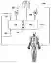 Fig. 01 - Total artificial heart system for auto-regulating flow and pressure balance