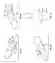 Fig. 09 - Diaphragm entry for posterior surgical access