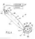 Fig. 02 - Fixator with membrane
