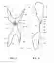 Fig. 04 - Knee brace