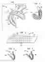 Fig. 02 - Shock absorbing dental device