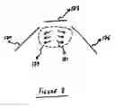 Fig. 09 - Method and apparatus for high-gain magnetic resonance imaging