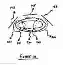 Fig. 11 - Method and apparatus for high-gain magnetic resonance imaging