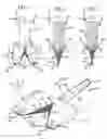 Fig. 02 - Dual arcuate blade probe tip