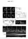 Fig. 02 - MRCK-related compositions and methods