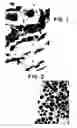 Fig. 02 - METHOD FOR TRANSDIFFERENTIATION OF BODY TISSUES
