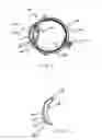 Fig. 02 - Mazaheri LASIK method for visual enhancement