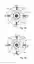 Fig. 02 - Method and system for radio frequency ophthalmological presbyopia surgery