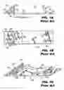 Fig. 02 - Apparatus for axial compression of a patient's spine