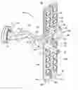 Fig. 01 - Surgical fixture device and method for supporting a patient during surgery