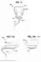 Fig. 07 - Adjustable vaginal splint for pelvic floor support