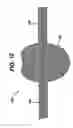 Fig. 08 - Adjustable vaginal splint for pelvic floor support