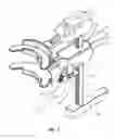 Fig. 08 - TISSUE STRETCHING DEVICE