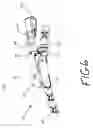 Fig. 07 - Climbing Device with Removable Step