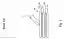 Fig. 02 - Method for gesture detection on a capacitive touchpad