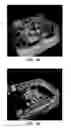 Fig. 04 - Occlusion culling for object-order volume rendering