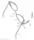 Fig. 06 - Combination of eyeglasses and attachment glasses