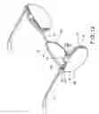 Fig. 11 - Combination of eyeglasses and attachment glasses