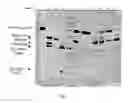 Fig. 02 - Plasma cryoprecipitate substantially free of plasminogen