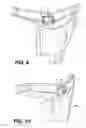 Fig. 08 - Outboard Engine Cowling