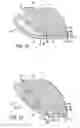 Fig. 09 - Reduced ply separation tail seal