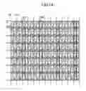 Fig. 07 - Liquid crystal display with plural gate lines and pairs of pixels