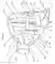 Fig. 02 - Surgical headlight