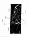 Fig. 09 - Methods of reducing aggregation of IL-1ra