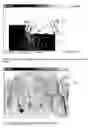 Fig. 06 - Method and system for comprehensive evaluation of orthodontic treatment using unified workstation