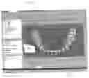 Fig. 43 - Method and system for comprehensive evaluation of orthodontic treatment using unified workstation