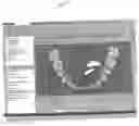 Fig. 45 - Method and system for comprehensive evaluation of orthodontic treatment using unified workstation