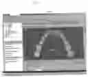 Fig. 49 - Method and system for comprehensive evaluation of orthodontic treatment using unified workstation