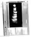 Fig. 83 - Method and system for comprehensive evaluation of orthodontic treatment using unified workstation