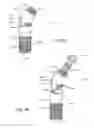 Fig. 02 - Implant having integral flexible abutment portion and method for use thereof