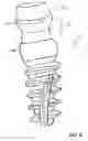 Fig. 09 - Condensing skeletal implant that facilitate insertions