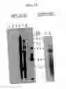 Fig. 02 - Methods and compositions for treating cervical cancer