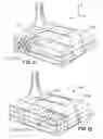 Fig. 08 - Method of golf club performance enhancement and articles resultant therefrom
