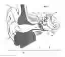 Fig. 02 - Output transducers for hearing systems