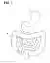 Fig. 02 - Capsule type medical device