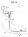 Fig. 13 - Endoscope system equipped with manipulating unit for commanding medical therapy to endoscope and medical instrument attached thereto