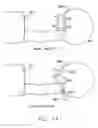 Fig. 12 - Noninvasive measurement system