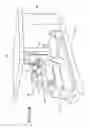 Fig. 03 - Apparatus and method for delivering ablative laser energy and determining the volume of tumor mass destroyed