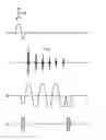 Fig. 01 - MR system and operating method therefor allowing selection of points in time of signal readout
