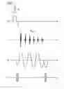 Fig. 02 - MR system and operating method therefor allowing selection of points in time of signal readout