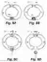 Fig. 14 - Apparatus and method for image guided insertion and removal of a cannula or needle