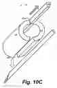 Fig. 17 - Apparatus and method for image guided insertion and removal of a cannula or needle