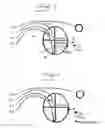 Fig. 05 - Apparatus for detecting diastolic heart failure