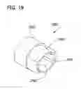 Fig. 20 - Electronic thermometer with sensor location