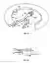 Fig. 04 - Method and apparatus for body fluid sampling and analyte sensing